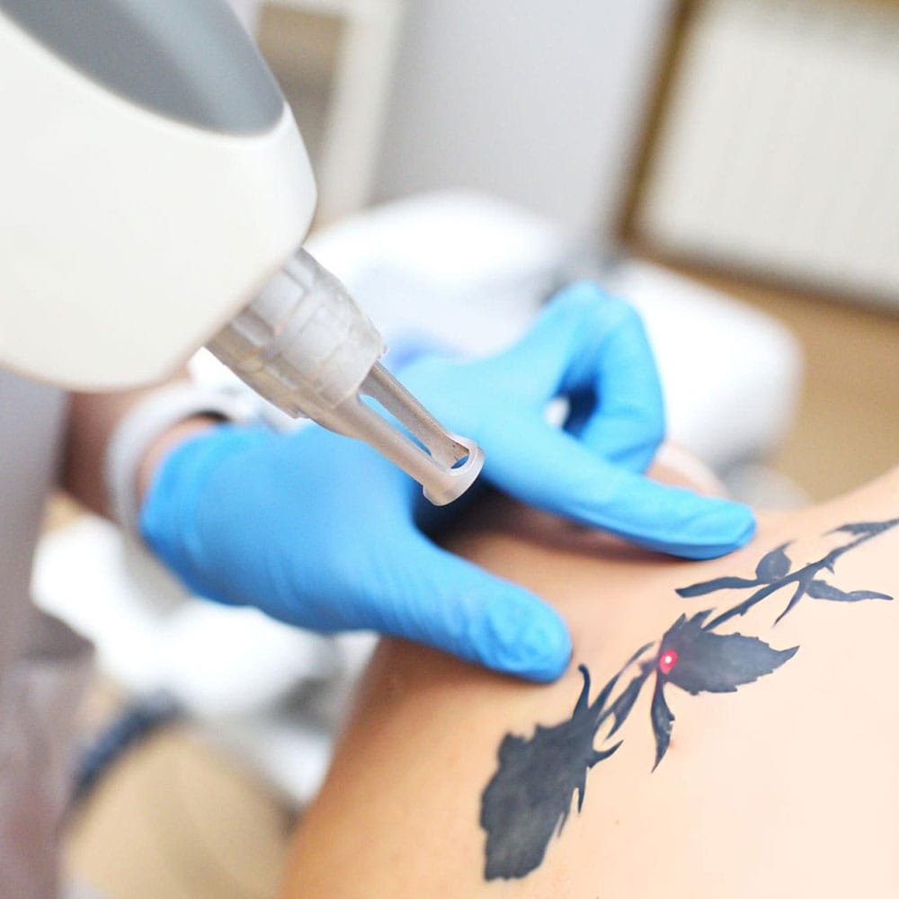 Advanced Tattoo Removal Training Deposit - February 28